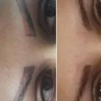 ۵۰درصد تخفیف پاک کردن تاتو .فشیال وپاکسازی|خدمات آرایشگری و زیبایی|قرچک, زیبا شهر|دیوار