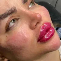 استخدام هنرجو آموزشی وخدمات ژل بوتاکس|خدمات آموزشی|اصفهان, برازنده|دیوار