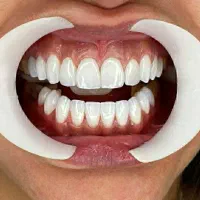 دندانپزشکی زیبایی تخفیف شب یلدااقساط