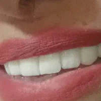 لابراتوار دندان سازی مرجان