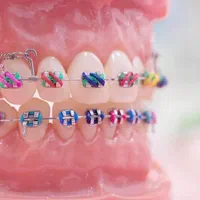 ارتودنسی اقساطی بدون ضامن