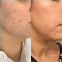 پوست صاف|خدمات آرایشگری و زیبایی|تهران, قبا|دیوار