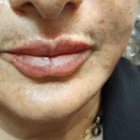 پوست و زیبایی|خدمات آرایشگری و زیبایی|تهران, مختاری|دیوار