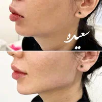 خدمات ژل عربی ‌خلیجی زیبادرکلینیک