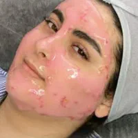 آموزش صفر تا صد پاکسازی پوست در کلینیک با مدرک فنی