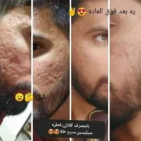 مشاوره پوست و مو
