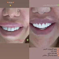 استخدام ویزیتور و بازاریاب کامپوزیت دندان|استخدام بازاریابی و فروش|یاسوج, |دیوار