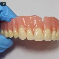 دندانسازی الماس