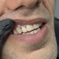 دندانسازی علی نیکو