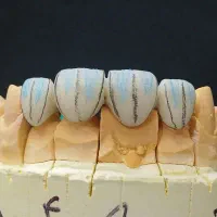 استخدام در دندانسازی