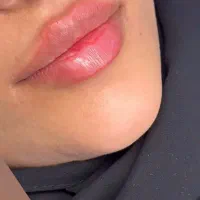 ژل بوتاکس آنزیم مزوتراپی پرسینگ فشیال فیلر|خدمات آرایشگری و زیبایی|مشهد, صیاد شیرازی|دیوار