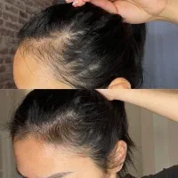 کلینیک تخصصی پوست ومو «پی آر پی،اگزوزوم،مزوتراپی»|خدمات آرایشگری و زیبایی|شیراز, عفیف‌آباد|دیوار