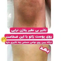 لیزر موهای زائد بدن|خدمات آرایشگری و زیبایی|شیراز, تحویلی|دیوار