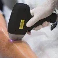 لیزر موهای زائد با قیمت استثنایی فقط این هفته