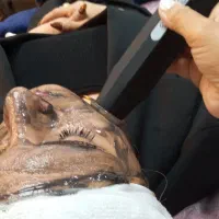 تخفیف خدمات پاکسازی ،فیشال درمانی ،اصلاح صورت