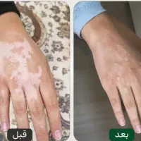 من به معجزه دستانم ایمان دارم