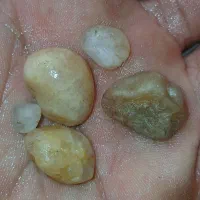 سنگ قیمتی