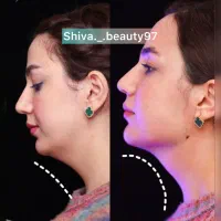 تخفیفات بهاره کلینیک زیبایی دکتر سعیدی