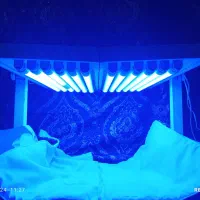 دستگاه زردی نوزاد