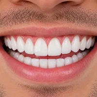 اقساط ۶۰ ماهه کامپوزیت/ لمینت/ایمپلنت ، دندانپزشکی|خدمات زیبایی و سلامت|تبریز, |دیوار