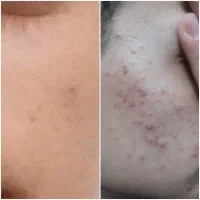 مشاور تخصصی پوست و مو رایگان