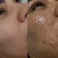 خدمات پاکسازی و فشیال تخصصی|خدمات آرایشگری و زیبایی|یاسوج, |دیوار