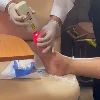 مرکز تخصصی درمان زخم در منزل(دیابتی ، بستر ،جراحی)