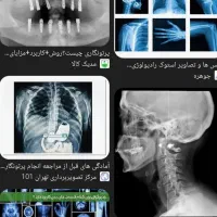 خ عکس های  طلقی رادیولوژی و سونوگرافی