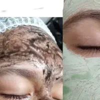 پاکسازی میکرودرم