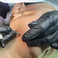 لیزر موهای سفید و سیاه با جدیدترین دستگاه‌ها|خدمات آرایشگری و زیبایی|رشت, گلسار|دیوار