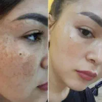 (کرم معجزه )دستساز متخصص تهران