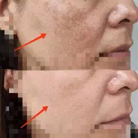 خوراکی برای سیستم ایمنی