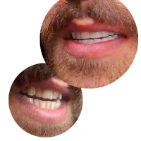 خدمات دندان