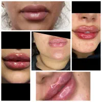 زیبایی پوست ومو|خدمات آرایشگری و زیبایی|ایذه, |دیوار