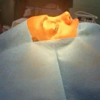 جراحی اسلیومعده بینی کاشت مو ابرو ریش سینه نیاوران|خدمات زیبایی و سلامت|تهران, نیاوران|دیوار