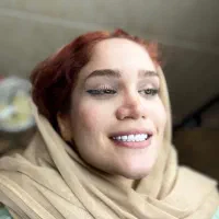 کامپوزیت دندان دو فک ۹ملیون500 ترمیم کامپوزیت|خدمات آرایشگری و زیبایی|تهران, ائمه اطهار|دیوار