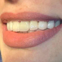 دندانپزشکی/لمینیت/ایمپلنت ( نصف قیمت تعرفه )|خدمات آرایشگری و زیبایی|تهران, فلسطین (میدان انقلاب)|دیوار