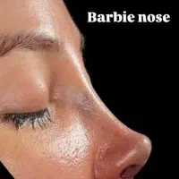 جشنواره جراحی و عمل بینی در کرج|خدمات آرایشگری و زیبایی|چهارباغ, |دیوار