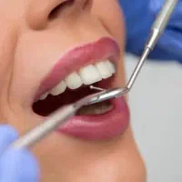 دستیار دندانپزشک