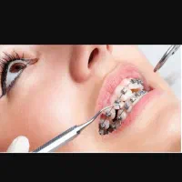 راهنمای ارتودنسی دندان