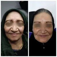 جشنواره یلدایی دکتر نفیسه پور محمدی|خدمات آرایشگری و زیبایی|قم, نیروگاه|دیوار