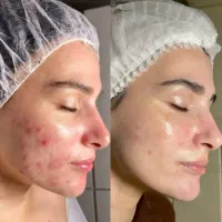 فیشال کارم با چندین سال سابقه