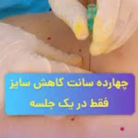 متد جدید لاغری با نخ های قابل جذب در مطب دکتر|خدمات آرایشگری و زیبایی|پاکدشت, پاکدشت (مامازند)|دیوار