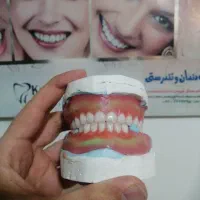 خدمات دندان و دندانسازی|خدمات آرایشگری و زیبایی|ارومیه, |دیوار