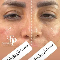 مطب پوست موزیبایی لیزرحذف تتوبالیزرQsبا۱۷سال تجربه|خدمات آرایشگری و زیبایی|تبریز, |دیوار