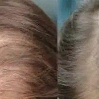 معجزه رویش موو ابرو باکوکتل های تخصصی برای خانم‌ها