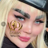 50% تخفیف تزریق تخصصی ژل وبوتاکس مادلینگ هایفو مزو