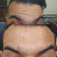 خدمات ژل و بوتاکس بانوان و آقایان|خدمات آرایشگری و زیبایی|پرند, فاز ۵|دیوار