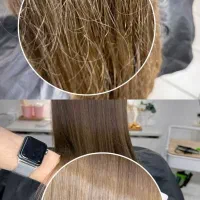 خدمات موخوره گیری