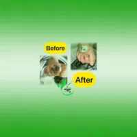 پانسمان ، زخم دیابتی،وکیوم تراپی